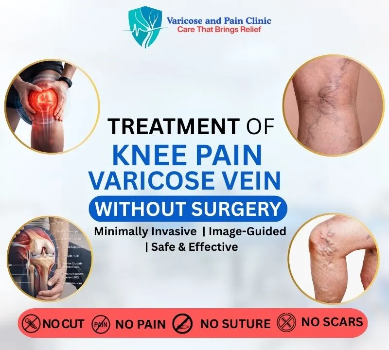 Poster showing non-surgical treatment for knee pain and varicose veins with minimally invasive image-guided procedures offering no cut, no pain, no suture, and no scars.