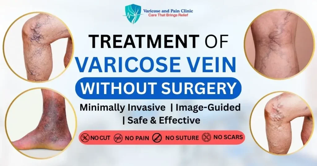 Laser treatment for varicose vein in jaipur